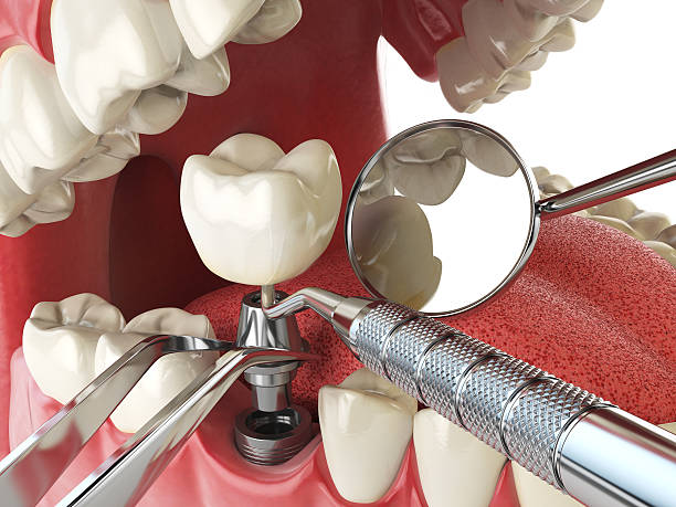 Best Pediatric Emergency Dentist in Webb City, MO